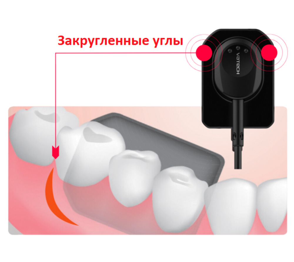 Vatech EzSensor Classic цифровой интраоральный радиовизиограф